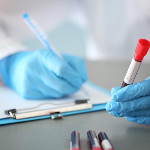 Woman working with blood sample in test tube at table